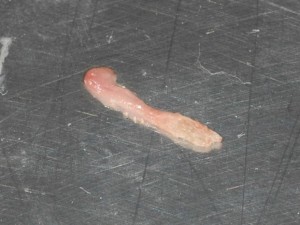 歯髄　歯周病専門医