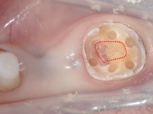 形成　歯周病専門医