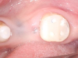 コア　歯周病専門医