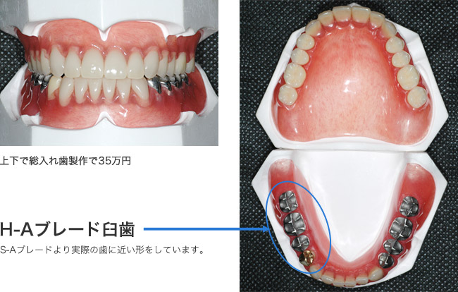 H-Aブレード臼歯